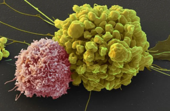 Guía sobre el Cáncer de Ovario